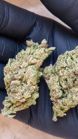 amnesia amnesia