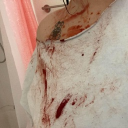 avatar vein