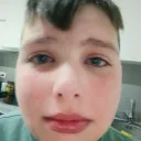 cxcochizp
