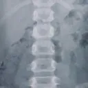 hiwcoaxten.zzz