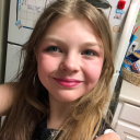 avatar Chicken little