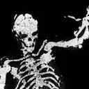 skeleski