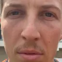 spodylodywodod