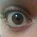 xylolazer