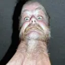 chlamydia_ballsniff_methington
