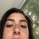 amylike.3