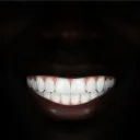 apyrexia