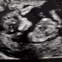 avatar Athena Arvanika