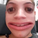 zerichasr