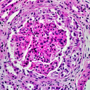 avatar Semiluna epitelial