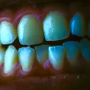 trionix2
