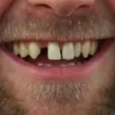 lafibrabianca