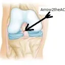 Arrow2theACL's Avatar