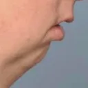 pikadidier