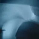 _foxki