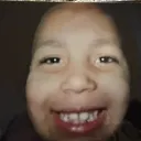 cantalupus
