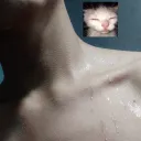 akalize