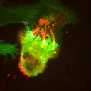 retrovirus.