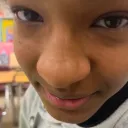 forehead69