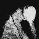 non.impetigo_