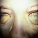zallows