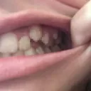 fyikoda