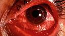 BloodShot Services Banner