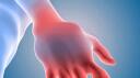 Carpal Tunnel Club Banner