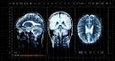 .gg/neurotica banner