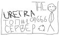 The Retry banner