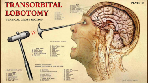 Lobotomy Club Discord server banner