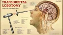 Lobotomy Club Discord server banner