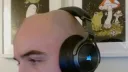 The Bald Zone banner