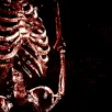 bloodskeleton