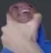 choke