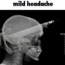 6037mildheadache