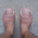 Toe