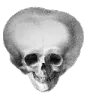 bigheadskull
