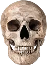skell