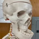 AHskull