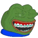 pepebraces4 pepebraces4