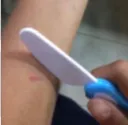 cuts