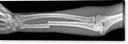 weekisarm