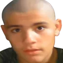 baldboi