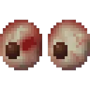 TowniesEyesBloodshot