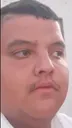 AlexOlhoTorto