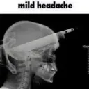 mildheadache Discord Emoji