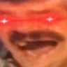 hyperkek