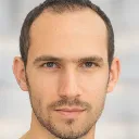 receding_hairline