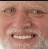 hidethepainharold
